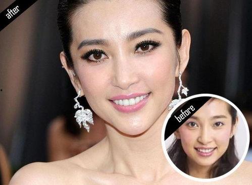 做过牙的明星,揭秘做过牙齿矫正的明星们